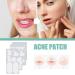 Gentle Solution for Stain Removal | 132 Pimple Spot Treatment for Smooth Skin - Buy Online on GoSupps.com