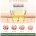 IPL Laser Hair Removal Device for Women and Men | Painless Hair Remover for Whole Body | 999,999 Flashes | Corded At-Home Treatment - Buy Online on GoSupps.com