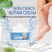 Foot Cream Callus Remover for Dry And Hard Skin Foot Nourishing Cream Deep Moisturizing Callus Remover and Soften Hard Skin Remover for Hand and Foot Care 50G - Buy Online on GoSupps.com