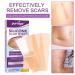 Silicone Scar Removal Sheets - Professional Strips for C-Section, Burns, Injuries & Acne - 5 Reusable Sheets - 5.9x1.6 - Buy Online on GoSupps.com