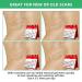 Tobcharm Keloid Scar Removal Gel - Effective Treatment for Piercing Bumps, Stretch Marks, and Surgical Scars | 30g Silicone Gel - Buy Online on GoSupps.com