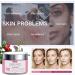 Skin Lightening Cream - Face Cream for Women - Dark Spot Corrector Remover - Face moisturizer for Anti Aging & Anti Wrinkles - Improve and Evens Skin Tone (50ml) - Buy Online on GoSupps.com