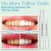 Teeth Whitening Pen Kit (4 Pcs) for Brighter Smile | Stain Remover Gel | Painless & Travel-Friendly - Buy Online on GoSupps.com