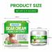 Natural Aloe Vera Scar Cream 20g Helps Soothe Acne Scars C-Section Scars Burns And Surgery Scars Works On Both Old And New Scars - Buy Online on GoSupps.com