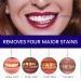 Teeth Whitening Pen 4 Pack - Visibly Whiter Teeth in 1 Week | Vanilla Mint | 70+ Uses | No Sensitivity - Buy Online on GoSupps.com