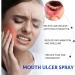 Mouth Ulcer Treatment Spray Oral Ulcer Sprays Ulcer Breath Sprays Canker Relief Spray Canker Sore Treatment Mouth Ulcer Spray Mouth Freshener Spray Breath Spray for Bad Breath Dry Mouth Oral Spray - Buy Online on GoSupps.com