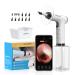 Ear Wax Removal Tool New 2023 Earigation Electric Ear Cleaning Kit Includes 1080P Camera & Video with Light Works with iOS & Android - Includes Basin Towel & 9 Tips Earwax Irrigation Kit