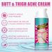 Shantou Yingji Shentiru Poacne cream acne cleansing cream for buttocks and thighs butt acne cream reduces acne acne cream for buttocks buttocks acne and pimples cleansing cream for pimples - Buy Online on GoSupps.com