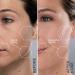 Michael Todd Beauty Sonicsmooth Pro+ Dermaplaning System - LED Light 2-in-1 Exfoliation & Peach Fuzz Remover - 16 Safety Tips & 2 Microdermabrasion Tips - Lavender - Shop Internationally Today - Buy Online on GoSupps.com