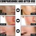 Deep Serum Rice + Alpha-Arbutin Face Glow Serum Brightening Serum Rice Serum Korean Skincare Serum Serum For All Skin Types Korean Face Serum Face Serum For Women Best Anti Aging Serum - Buy Online on GoSupps.com