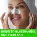 QUROMOJY Blackhead Strips - Charcoal Deep Cleaning Nose Strips (80 Counts) - Blackhead Remover for Men & Women - Buy Online on GoSupps.com