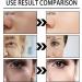 Snail Mucin Essence Snail Face Cream Snail Essence Face Cream Moisturizing Snail Repair Cream Powerful Facial Moisturiser Facial Moisturiser Anti Aging - Buy Online on GoSupps.com