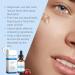 Glutathione Serum with Alpha-Arbutin Vitamin C & Niacinamide - Face Serum for Even Skin Tone Helps Improve Appearance of Dark Spots & Pigmentation Lightweight Formula for All Skin Types 1 fl oz - Buy Online on GoSupps.com