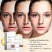 Benaewa Melanin Correcting Cream Dark Spot Remover for Body Moisturizing Skincare Cream - Buy Online on GoSupps.com