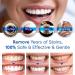 Teeth Whitening Essence Pen Gum Shield Gel Gum Repair Treatment Gel Gum Treatment Pen Teeth Whitening Toothpaste Gum Shield Gel Easy to Use with Soft Toothbrush(B) - Buy Online on GoSupps.com