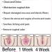 DUBUSH Anniecare Instant Antipruritic Detox Slimming Capsules Marine Fish Oil Pink Softgels Slimming Firming Repair & Natural Capsules Soft Pink - Buy Online on GoSupps.com