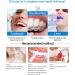Indulgences Corner Teeth Whitening Essence | Sensitive Teeth Whitening Pen | Fast Tooth Stain Removal (4PCS) - Shop Now! - Buy Online on GoSupps.com