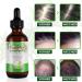 P-Beauty Rosemary Oil | Essential Oil for Hair Growth | Bio & Vegan | Pure Quality | 60ml | Ideal for Scalp Hair & Massage - Buy Online on GoSupps.com