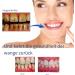Oral Gel for Gum Treatment - Effective Gum Protection Therapy (2PCs) | Neslemy Gum Gel - Buy Online on GoSupps.com