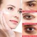 Retinol Eye Stick Retinol Eye Cream for Dark Circles and Puffy Eyes Eye Balm Stick Under Eye Cream Anti Aging Reducing Fine Lines Eye Brightener Stick Reduces Wrinkles Saggy Skin Puffy Eyes - Buy Online on GoSupps.com