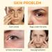 Vitamin C eye Cream 20gVitamin Essence anti-Wrinkle Anti-aging Lighten dark circles Improve Crow's Feet Eye Care Anti-Edema and eye Bags Moisturizing Eye Cream - Buy Online on GoSupps.com