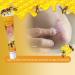 Professional Psoriasis Treatment Cream with New Zealand Bee Venom - Soothing & Moisturizing Formula - 5PCS - Buy Online on GoSupps.com