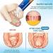 Gel Correcteur De Phimosis Ingr dients Naturels Gel Correcteur De Phimosis Exc s De Pr puce Action Rapide Et Douce (1pcs) - Buy Online on GoSupps.com