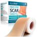 Silicone Scar Tape(1.6"  120"Roll-3M), Medical Silicone Scar Sheets, Strips, Scars Away, Effective Professional Scar Removal Sheets for Keloids, Tummy Tuck, C-Section, Acne, Burn et 1.6x120 Inch (7-8 Month Supply)