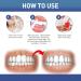 Teeth Pen for Your Teeth - Teeth Gel Pen for Teeth - Teeth Stain Remover - 4ml - Buy Online on GoSupps.com