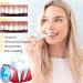Liacsy 7 Day Active Gum Treatment - Antibacterial Gel for Clean Gums & Stain Removal | International Shipping - Buy Online on GoSupps.com