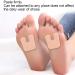 Schwiel Protection Callus Pads Reduce Friction & Relieve Pain for Figure Skaters Hikers & Long-Haul Runners | International Shipping Available - Buy Online on GoSupps.com