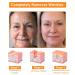 PureFlawless Powerful All-Body skin Treatment Cream Professional Bee Venom Skin Treatment Cream PureFlawless Bee Venom Skin Therapy Cream Natural Bee Venom Cream Suitable for All Skin Types (3PCS) - Buy Online on GoSupps.com