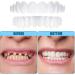 Brigtviee Clipin veneers 2 pairs of instant veneers upper and lower dentures Confidence Smile prostheses comfortable veneers for men and women - Buy Online on GoSupps.com