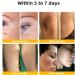 Zoencgz LIPOGO Bee Venom Cream New Bee Venom Treatment Cream Lipogo Professional Bee Venom Repair Cream for All Parts of The Body (1 Pack) - Buy Online on GoSupps.com