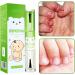 Nail Bite Prevention - 10ml for Stop Thumb Suck - Safe and Gentle Prevents Finger Sucking Habits for Home Kindergarten Travel Outdoors and - Buy Online on GoSupps.com