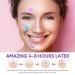 Senhorita 144Pcs Colorful Hydrocolloid Acne Patches with Green Algae Extract & Tea Tree Oil - Cover, Reduce Zits, Pimples, Blemishes - 144 Count - Buy Online on GoSupps.com
