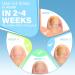 Ingrown Toenail Treatment Kit | Drops Softener & Double-Sided Pedicure Tool for Easy Care | Perfect Solution for Thick Nails & Nail Pain Relief - Buy Online on GoSupps.com