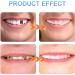 Giural Temporary Denture Instant Veneers Natural Denture Fake Tooth Perfect Smile Removable Upper and Lower Denture for Men and Women Teeth Whitening - Buy Online on GoSupps.com