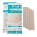 Longmed Silicone Scar Sheets for C-Section Keloid Post Surgery and Acne Scars Removal Treatment - Silicon Soft Long Strips & Sheets 4 Pack 7 x 1.57 - Healing Alternative to Gel Tape & Cream