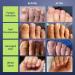 Effective Nail Fungus Light for Toenail & Fingernail Treatment | Restore Damaged & Discolored Nails - Buy Online on GoSupps.com