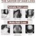 Natural Hair Growth Oil for All Hair Types - Nourishing Scalp Treatment (2pcs) - Buy Online on GoSupps.com