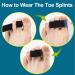 Kimihome Toe Splints - Corrector for Overlapping Toe, Hammer & Crooked Toes - 10 Packs of Toe Tapes - Black - Buy Online on GoSupps.com