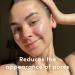 Sand & Sky Australian Pink Clay Deep Pore Cleanser 4.05 fl oz - pH 5.5 Gel Cleanser for Clear Skin, Reduce Pores, Exfoliate, Hydrate & Moisturize - Buy Online on GoSupps.com