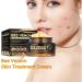 Bee Venom Skin Restoration cream Bee Venom Skin Treatment Cream Softens and rejuvenates skin - and reduces imperfections (4PCS) - Buy Online on GoSupps.com