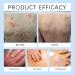 Itchaway Cream skin care cream mild nonirritating gently softens and hydrates the skin suitable for all skin types 1 Pieces - Buy Online on GoSupps.com