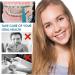 Buy INGJIA 10pcs Orthodontic Elastic Disposable Braces - Mixed Color - International Shipping Available - Buy Online on GoSupps.com