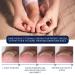 German Toenailcare Removal Oil | Paronychia & Ingrown Toenail Repair | Anti-Paronychia Relief Liquid for Nail Renewal - Buy Online on GoSupps.com