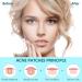 Acne Pimple Patches 180 Patches - Invisible Hydrocolloid Zit Patch for Face (5 Packs) | 2 Sizes Included - Buy Online on GoSupps.com