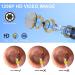 3.9mm HD Ear Scope Endoscope with Earwax Removal Tools - iPhone, iPad, Android Compatible - Buy Online on GoSupps.com