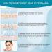 Henda Silicone Scar Sheets 1.6x120 Tape Roll - Professional Removal for C-Section, Burn, Acne, Keloid - Reusable & Softens Scars - Buy Online on GoSupps.com